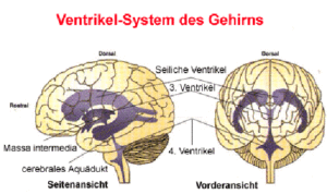 NF2 Liquorsystem Ventrikel System des Gehirns Bundesverband Neurofibromatose